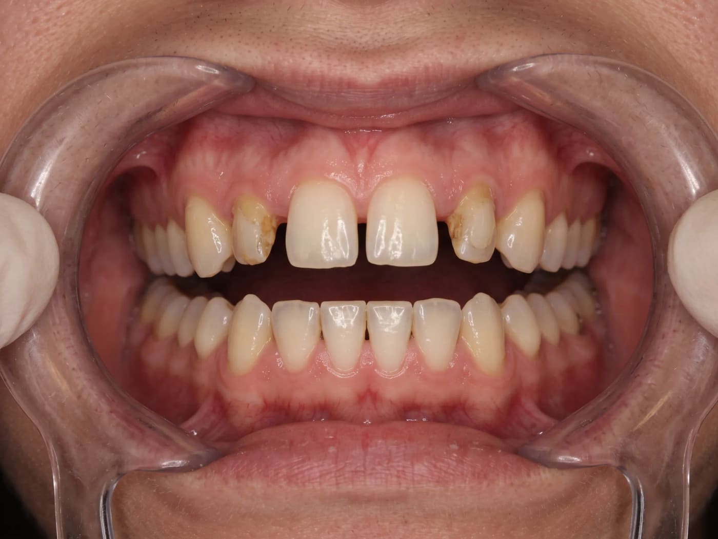 Case 031, Before
